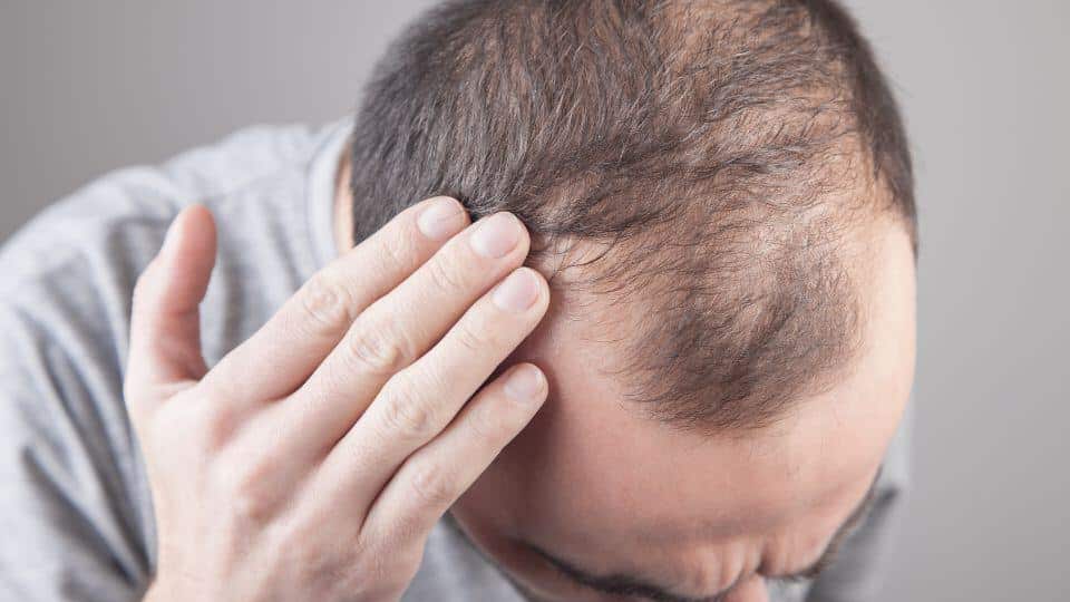 איך למנוע נשירת שיער