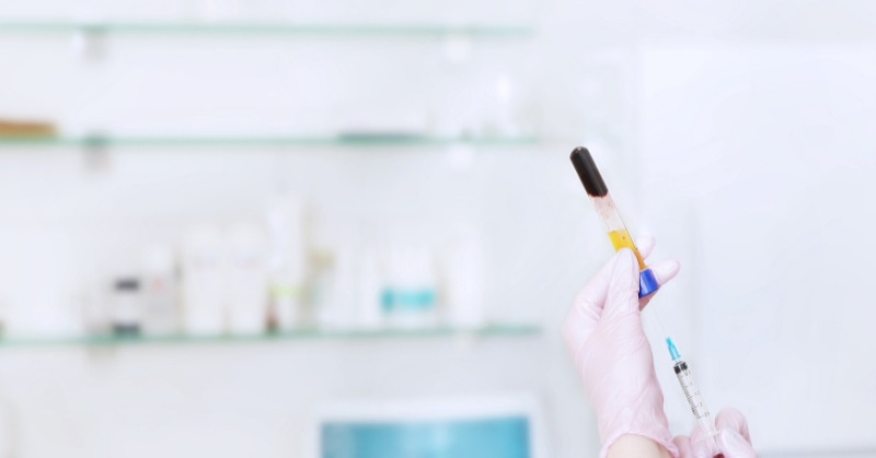 טיפול PRP – הטכנולוגיה שמחזירה לגוף את היכולת לרפא את עצמו